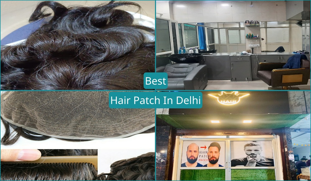 Best Hair Patch In Delhi